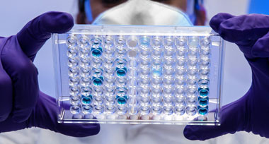 Stockage d’échantillons biologiques
